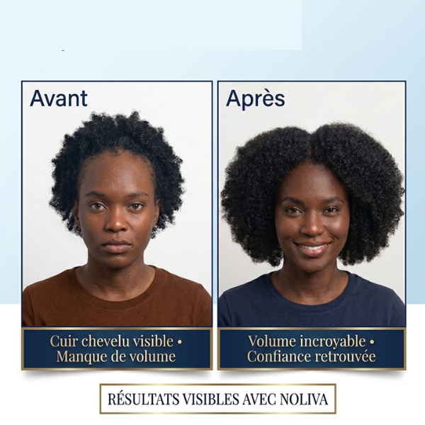 NOLIVA – Sérum Croissance & Renforcement Capillaire