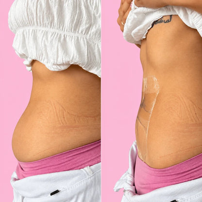 Noliva – Patchs Liftants Bras, Ventre, Corps & Effet Lissant